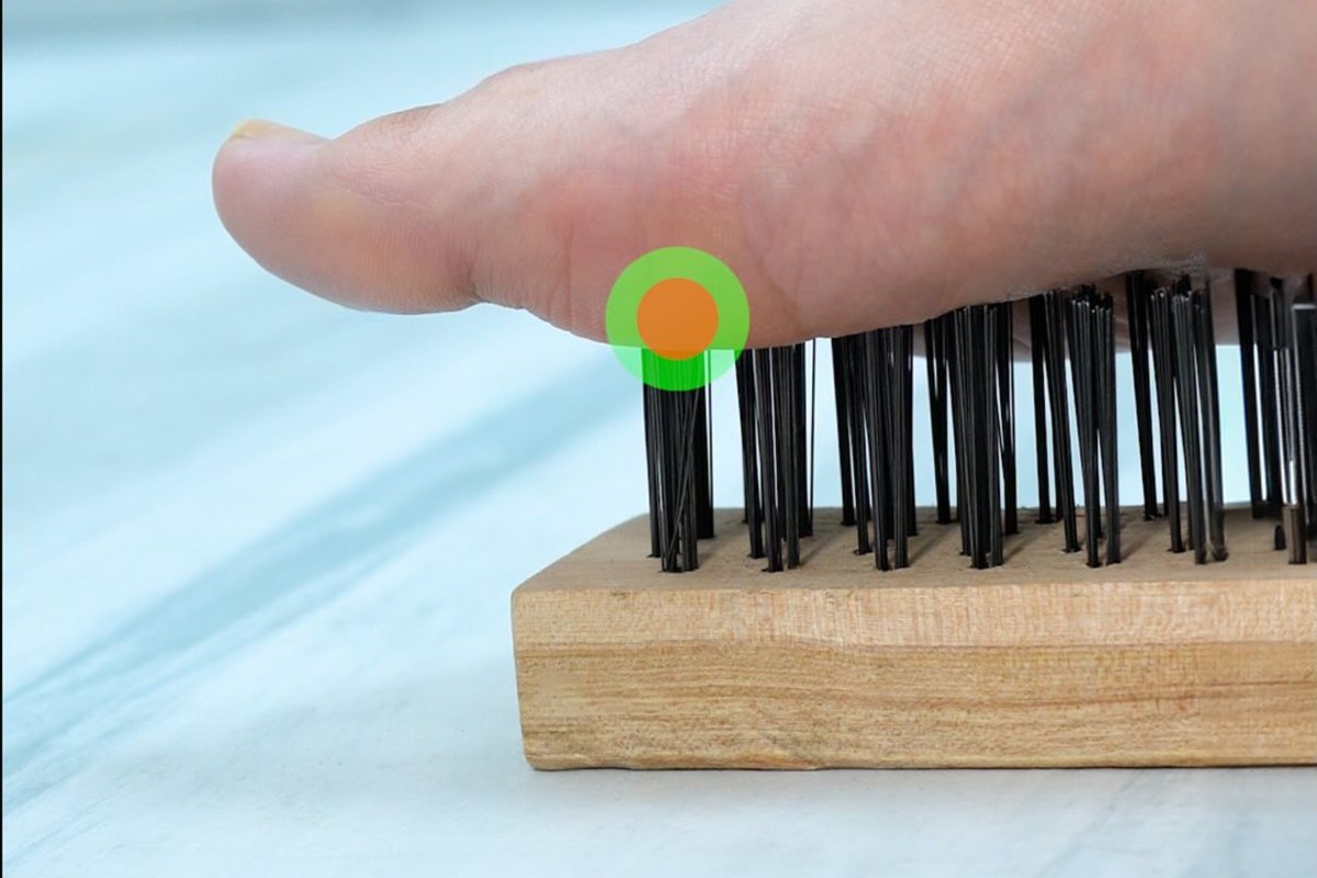 Neuroma de Morton: dolor como agujas en la planta del pie