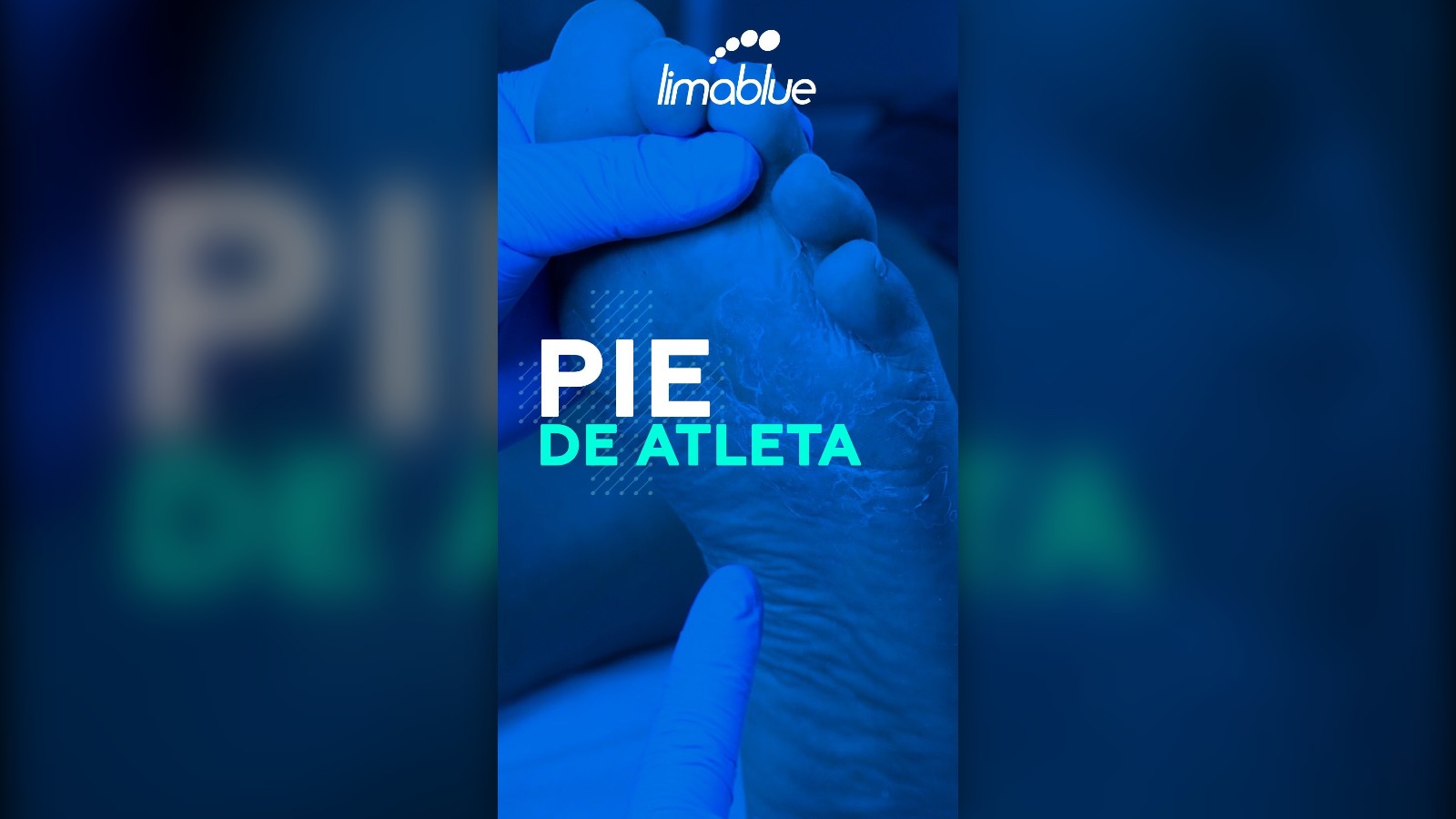 Pie de atleta: hongos en la piel del pie, explicado por Limablue