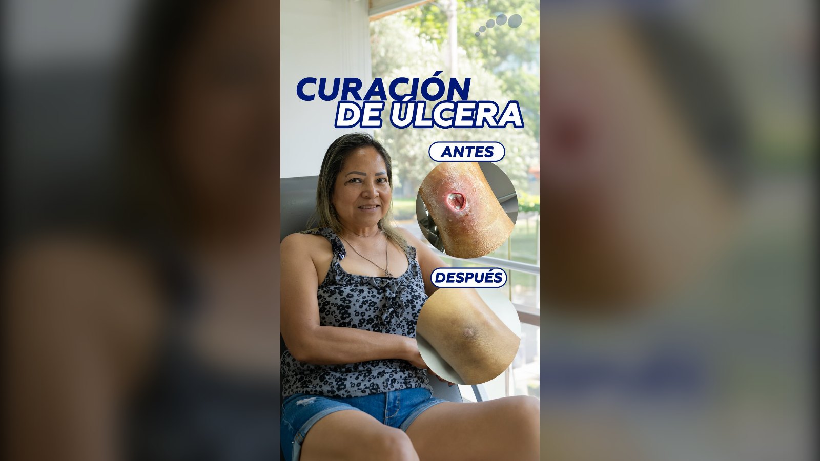 Curación de úlcera en pie diabético en Limablue: antes y después
