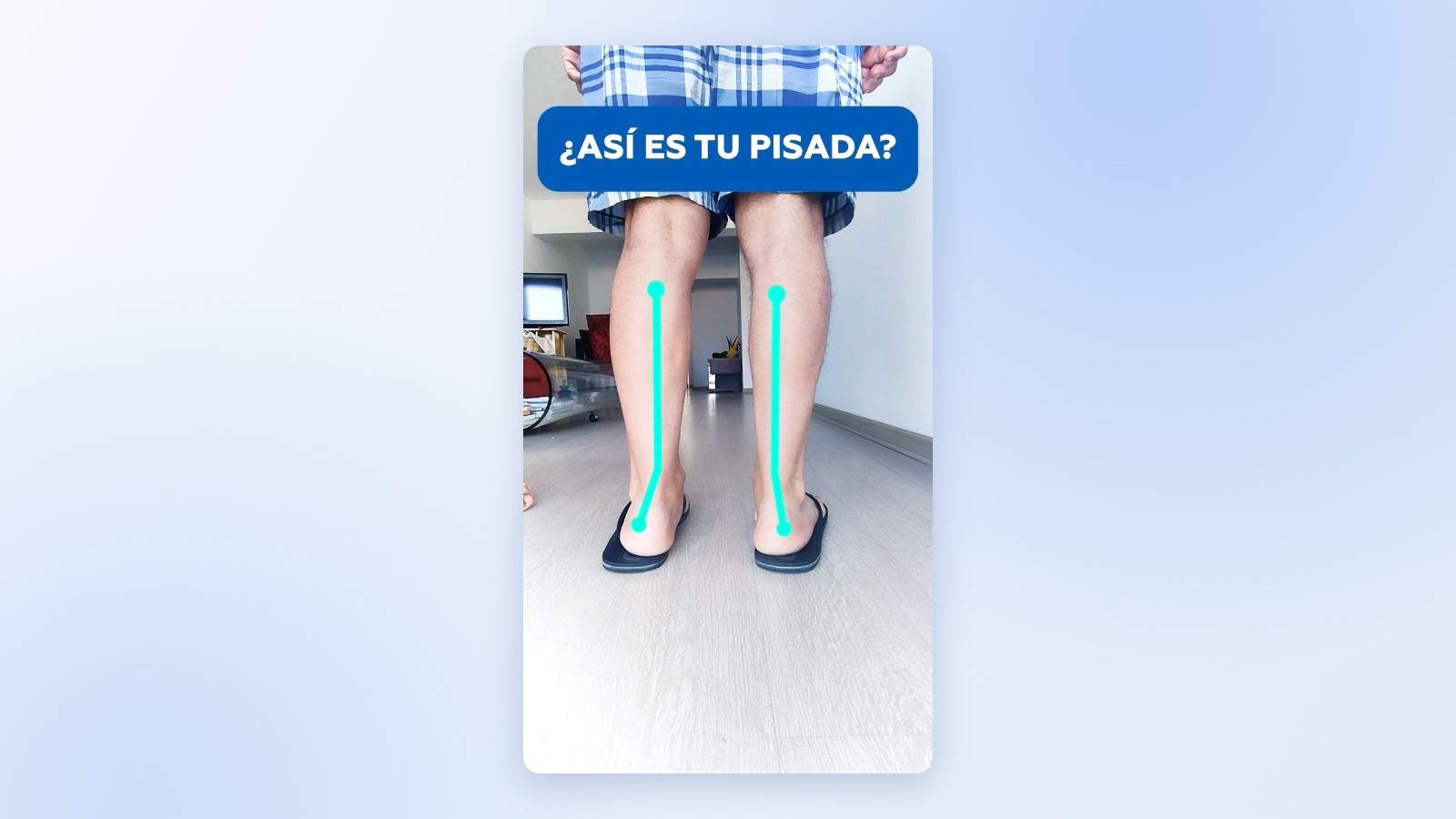 Pie plano en niños: evaluación de la pisada en Limablue