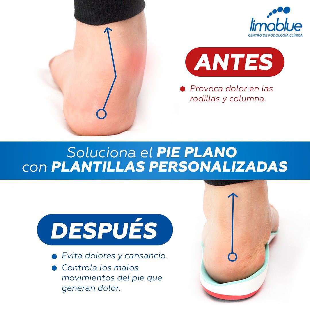 Pie plano antes y después de usar plantillas personalizadas