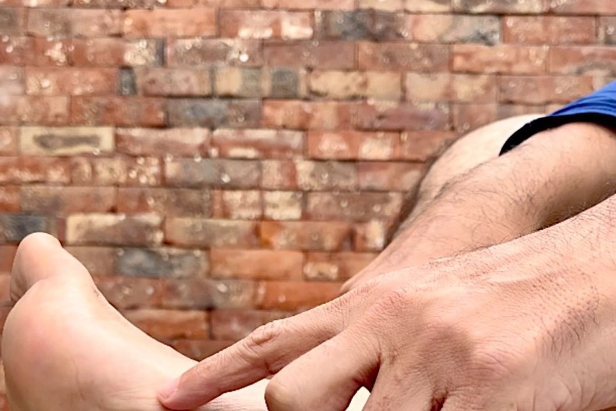 Tendinitis de Aquiles: paciente señala el tendón adolorido