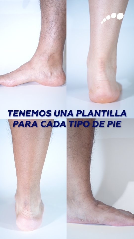 Distintos tipos de pie en niños y adultos