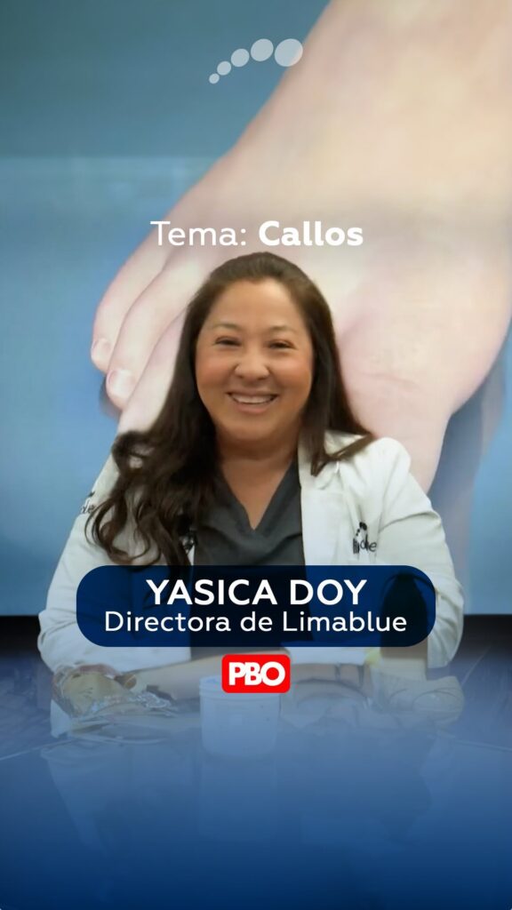 Yasica Doy, directora de Limablue, habla de callos en PBO